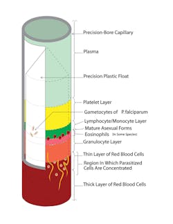 Dry Hematology Figure 2 Dry Hematology Figure 2