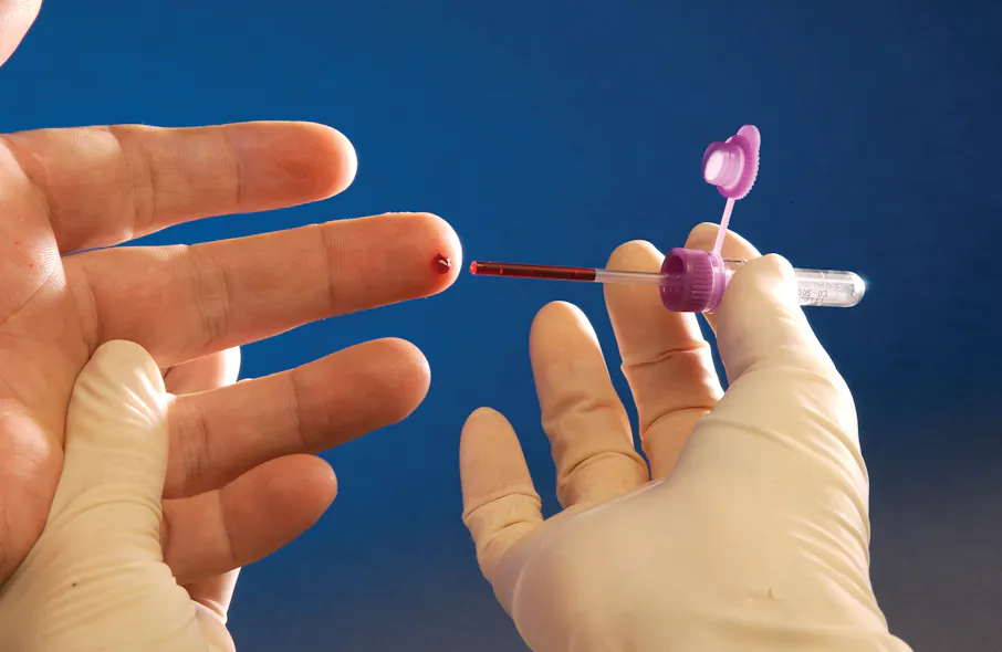 Capillary Finger Finger Stick Lead Testing | Testing Whole Blood for Lead – OIJXJA