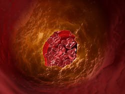 Adobe Stock 225300584 1 5ce2f893b90e7 Adobe Stock 225300584 1 5ce2f893b90e7