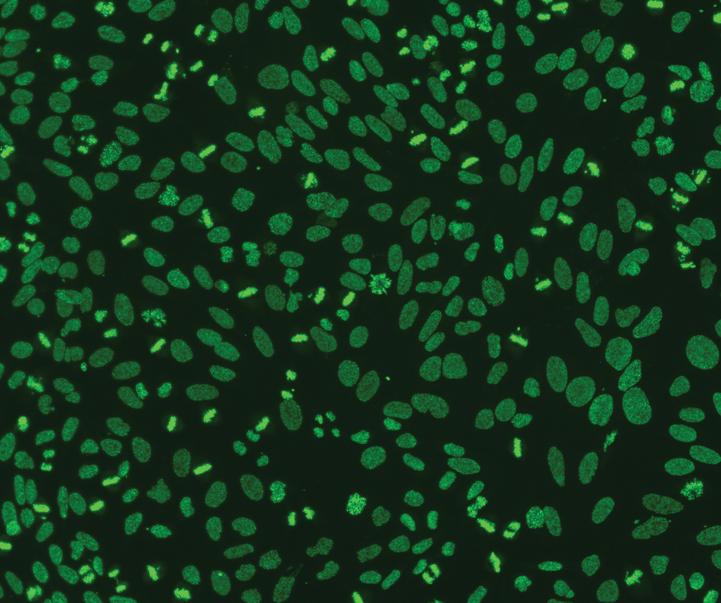 Isolated antiDFS70 autoantibodies Negative disease correlation with a