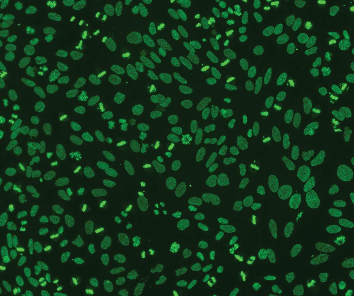 Figure 1. AC-2: Anti-DFS70 pattern on HEp-2 cells, courtesy of LMC, West Columbia, SC.