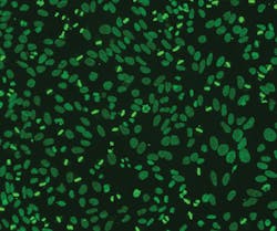 Figure 1. AC-2: Anti-DFS70 pattern on HEp-2 cells, courtesy of LMC, West Columbia, SC. Figure 1. AC-2: Anti-DFS70 pattern on HEp-2 cells, courtesy of LMC, West Columbia, SC.