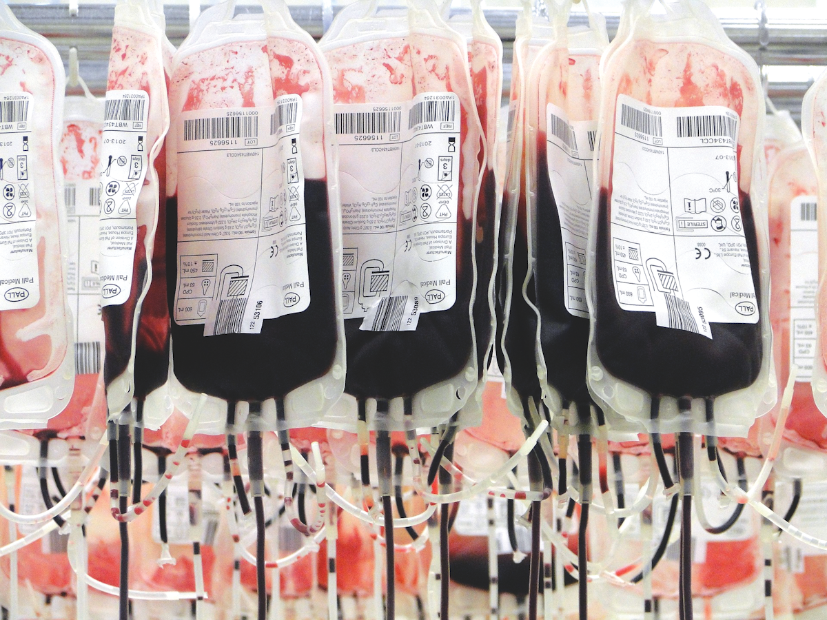 Is There One Standardized Transfusion Approach For Patients