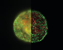 Figure 1. HeLa cell spheroid stained with Alexa Fluor 568 Phalloidin (Actin) and YOYO 1 iodide (Nucleus). Acquired with a standard wide field fluorescence microscope (left half) and an exposure of the same sample taken with a THUNDER imager (right half). Figure 1. HeLa cell spheroid stained with Alexa Fluor 568 Phalloidin (Actin) and YOYO 1 iodide (Nucleus). Acquired with a standard wide field fluorescence microscope (left half) and an exposure of the same sample taken with a THUNDER imager (right half).