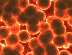 Bacteria 1959389 1920 Uva 5d36f8c9c933d Bacteria 1959389 1920 Uva 5d36f8c9c933d