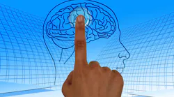 Brain 770044 1920 Mgh