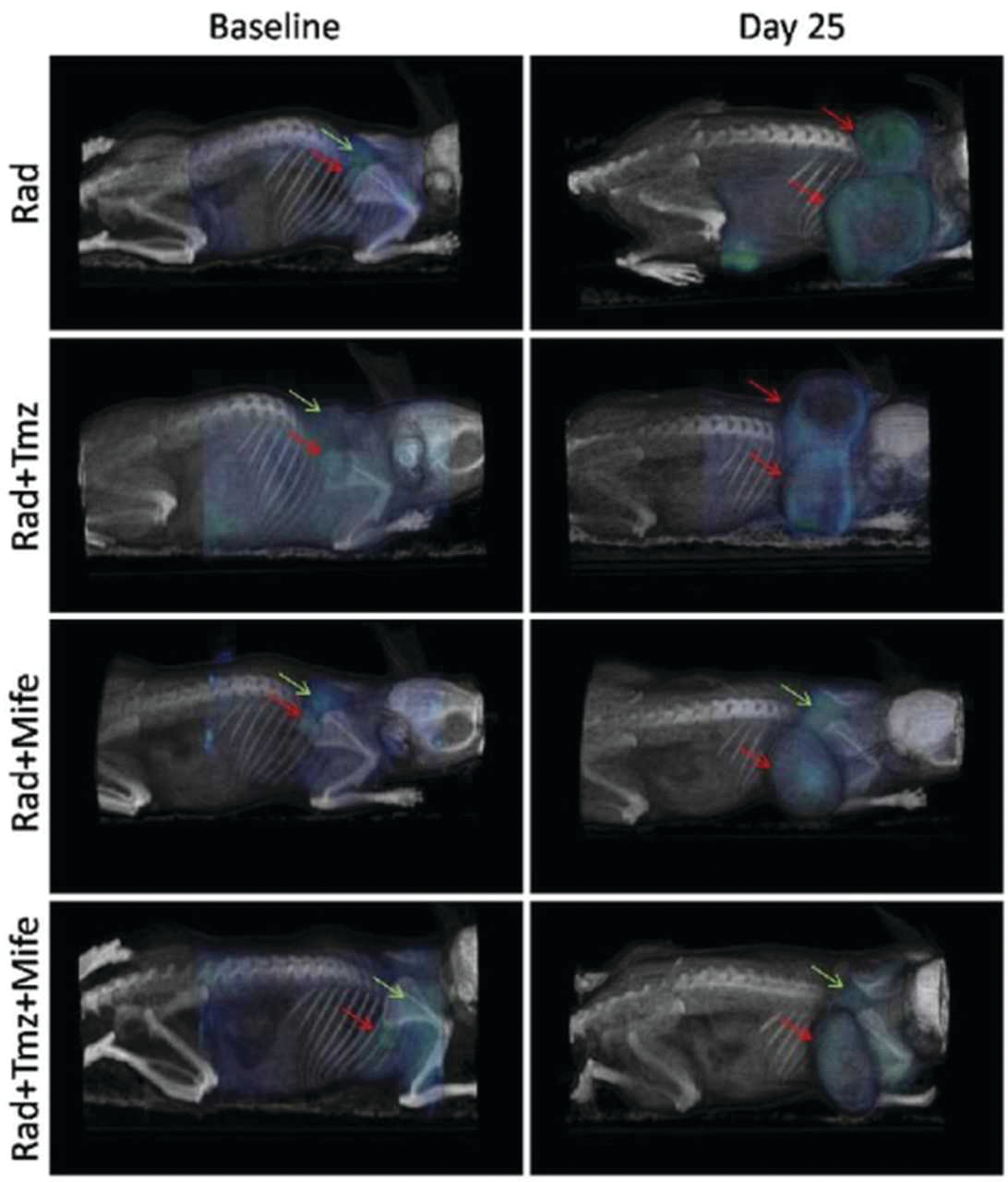 Figure 1. PET/CT images showing 18F-FDG tumor uptake, in four treatment combinations, at the beginning of treatment and 25 days later. Red arrows indicate tumor location at baseline and day 25, green arrows show sites of typical 18F-FDG uptake in brown adipose tissue (BAT). Reproduced from reference [1] in accordance with the Creative Commons License (https://creativecommons.org/licenses/by/2.0/).