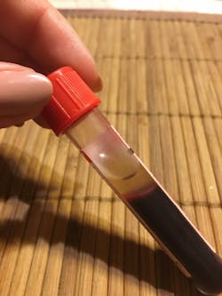 Blood 1765044 1920 5d53fd2baac32 Blood 1765044 1920 5d53fd2baac32