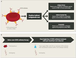 Figure 4. (A) Summary of anti-CD38 interference in blood bank testing. (B) Strategies to mitigate anti-CD38 interference in blood bank testing.7 Figure 4. (A) Summary of anti-CD38 interference in blood bank testing. (B) Strategies to mitigate anti-CD38 interference in blood bank testing.7
