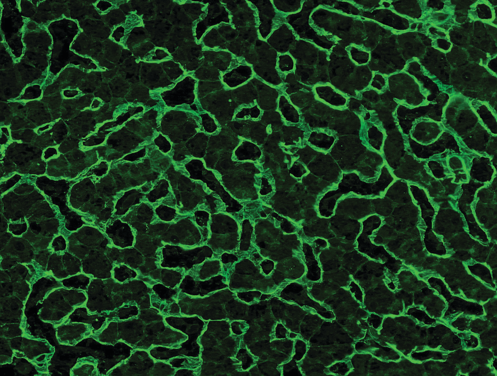 Detection of EmA by IFA on liver tissue.