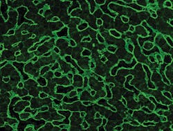 Detection of EmA by IFA on liver tissue. Detection of EmA by IFA on liver tissue.