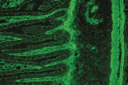 Detection of EmA by IFA on small intestine tissue. Detection of EmA by IFA on small intestine tissue.