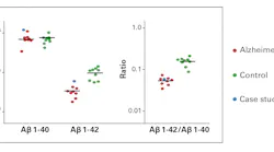 Figure 2. Case example of beta amyloid ratio calculation (Internal study)