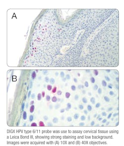 Hpv Mb 01 14 19 P5 5dd571236c694 Hpv Mb 01 14 19 P5 5dd571236c694