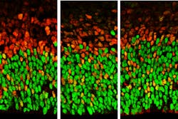 Ucla Pic 5e46ad21e8a35 Ucla Pic 5e46ad21e8a35