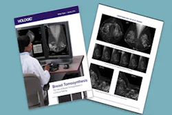 Hologic Whitepaper2 300x200 Hologic Whitepaper2 300x200