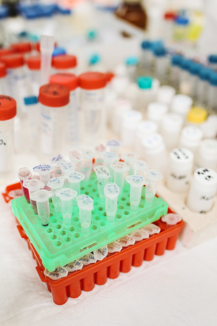Labcorp Launches Test For Covid 19 Medical Laboratory Observer