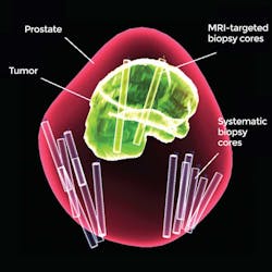 Combined Biopsy 5e62c6ef7d7ff Combined Biopsy 5e62c6ef7d7ff