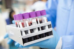 Pixabay Blood 4944423 1280 5e8dcdf1c0dd6 Pixabay Blood 4944423 1280 5e8dcdf1c0dd6