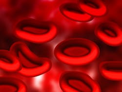 Pixabay Blood 75301 1280 5ea1986862074 Pixabay Blood 75301 1280 5ea1986862074