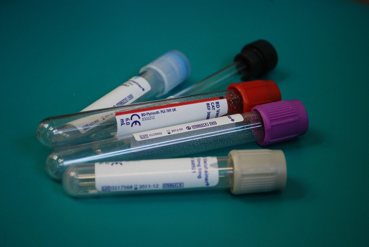 Pixabay Blood Test Tubes Laboratory 313864 1280 5e849ae8cb199
