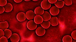 Pixabay Plasma Blood 75302 1280