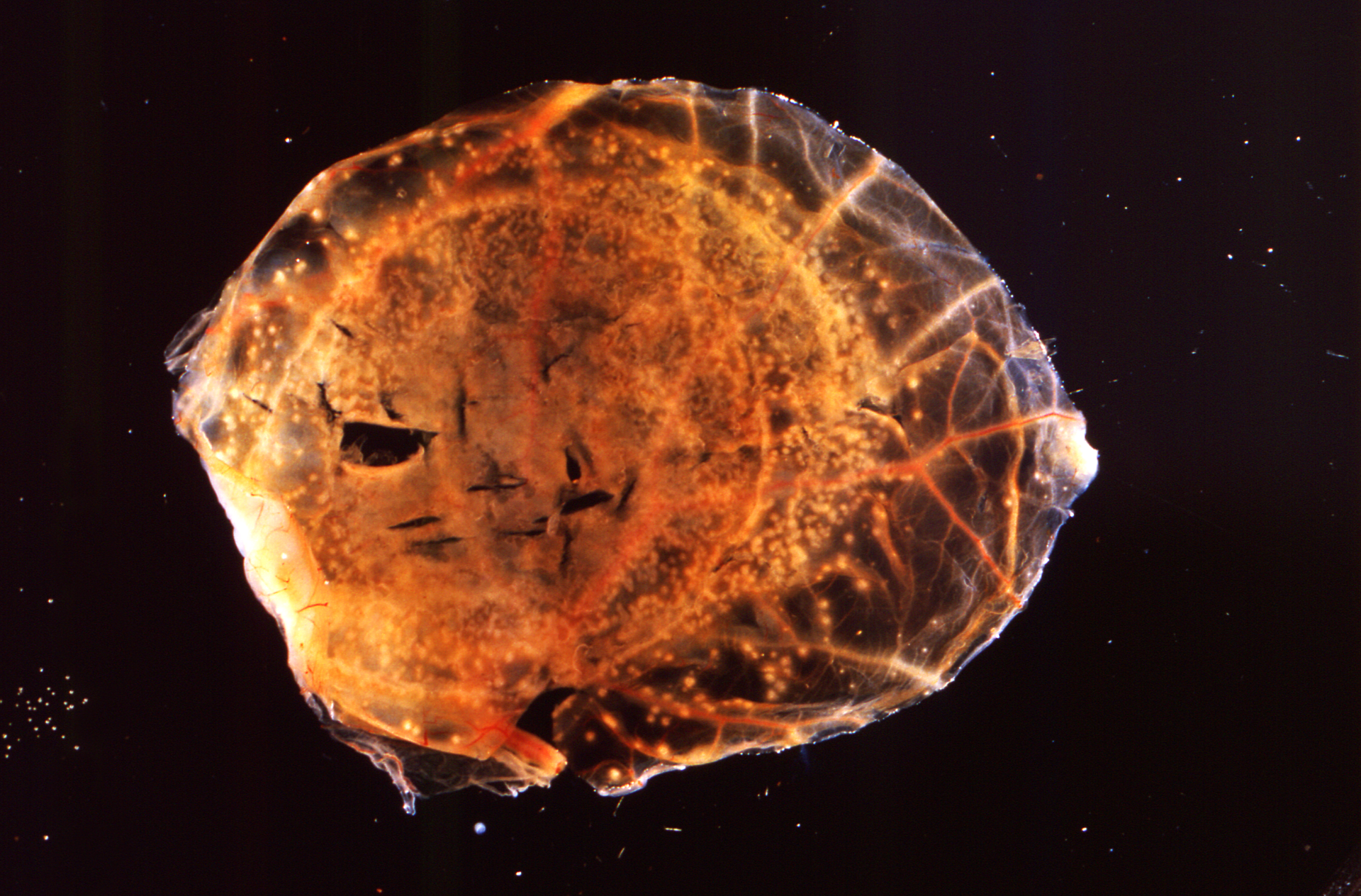 21396 Cdc Smallpox 5ebd4716dfdc9