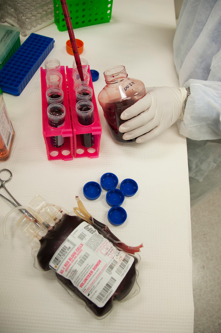 bioMérieux receives FDA clearance to extend platelet shelf life to