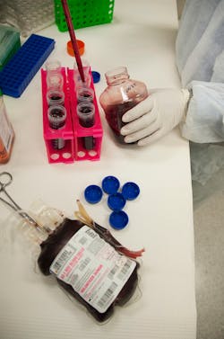 Fda Blood Cells 9759282085 9a7532b7b3 K 5ed10d0759cd5 Fda Blood Cells 9759282085 9a7532b7b3 K 5ed10d0759cd5