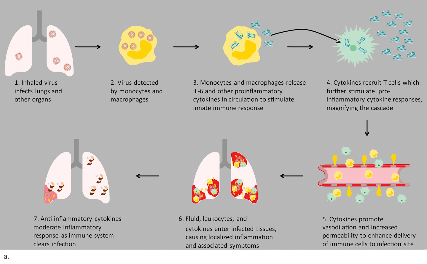 Covid 19 And Cytokine Storm Syndrome Medical Laboratory Observer Covid 19 And Cytokine Storm Syndrome Medical Laboratory Observer