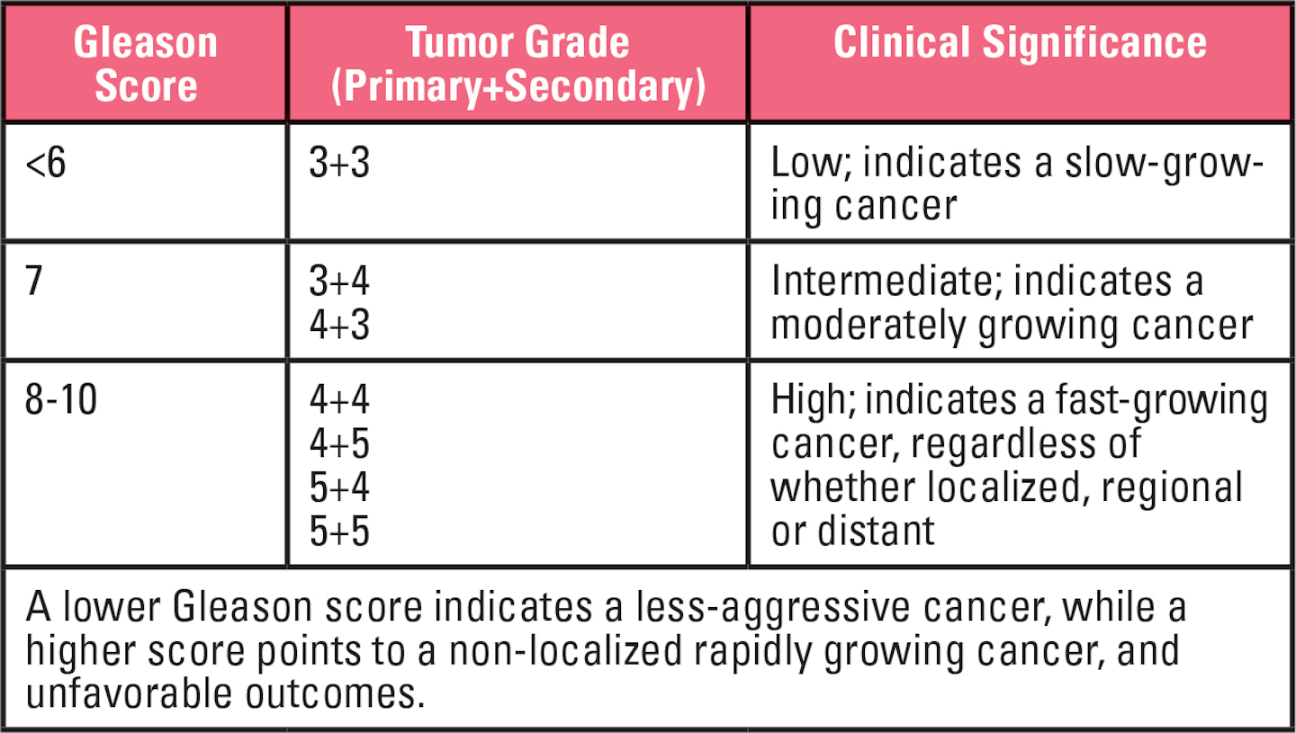 Five clinical challenges laboratories need to understand about prostate
