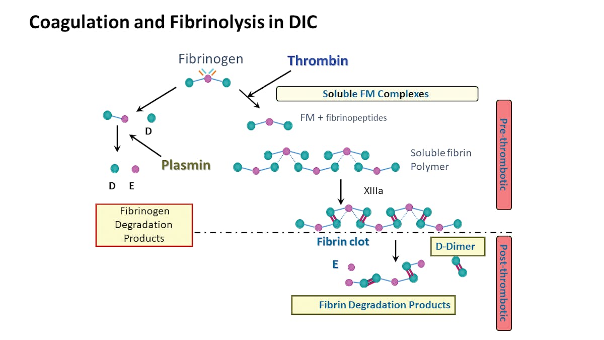Coagulation and fibrinolysis in disseminated intravascular coagulation (DIC), specifically showing fibrin degradation product (FDP), fibrin monomer (FM), and D-dimer development before and after VTE occurrence, along with the formation of D and E fragments.