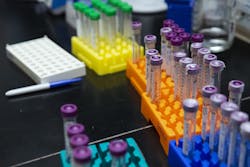 Needpix Colorful Test Tubes 4187286 1280 1 5ec5317ae8cc6 Needpix Colorful Test Tubes 4187286 1280 1 5ec5317ae8cc6