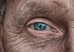 Pixabay Human Eye 3358873 1280 5ed10dfb7b0eb Pixabay Human Eye 3358873 1280 5ed10dfb7b0eb