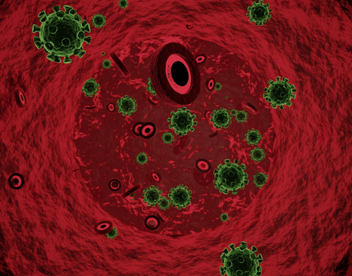 Total Antibody Test From Bio Rad Laboratories Granted Eua From Fda Medical Laboratory Observer
