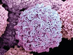 Breast Cancer Cells Photos 5ede3b0978ecf Breast Cancer Cells Photos 5ede3b0978ecf