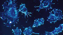 Pixabay Cancer Cells 541954 1280 (1)
