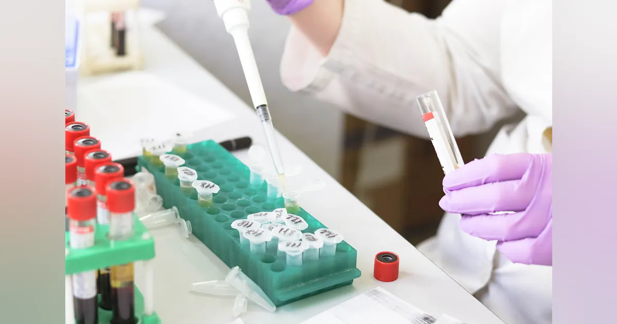 Naias Lab Sample Collection FDA issues EUA for nasal specimen self-collection kits | MLO Online
