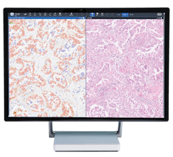 Roche 4 Dp U Path 263 Product Image Pdp Marketing Content 5ef9e7c662361 Roche 4 Dp U Path 263 Product Image Pdp Marketing Content 5ef9e7c662361