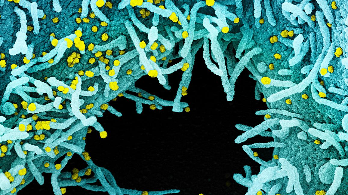 20200714 Covid Nih 5f104cd32f753