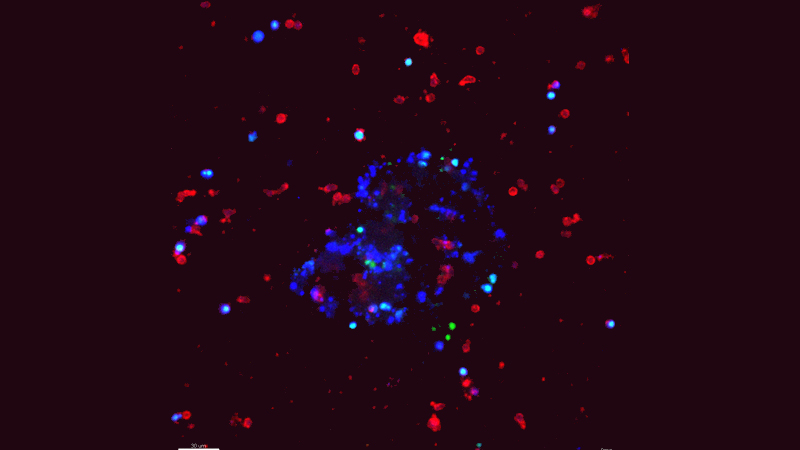 7 9 2020 Valerie Pr Ewald Image Jhu 5f104b60b86a6