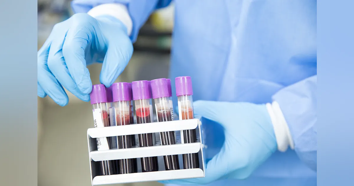 COLA publishes 2020 Laboratory Accreditation Manual with new criteria ...