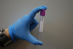 Pixabay Lab Vial Laboratory 313862 1280 5f0db2ed63f1e Pixabay Lab Vial Laboratory 313862 1280 5f0db2ed63f1e