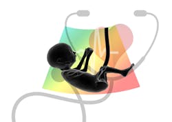 Ultrasound 4536367 1920 Placenta 5f1597c277916 Ultrasound 4536367 1920 Placenta 5f1597c277916