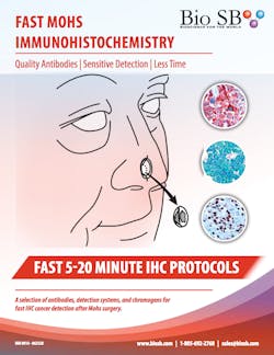Bio Sb Sept Fast Mohs Poly Detector Plus Ihc Detection System Bio Sb Sept Fast Mohs Poly Detector Plus Ihc Detection System