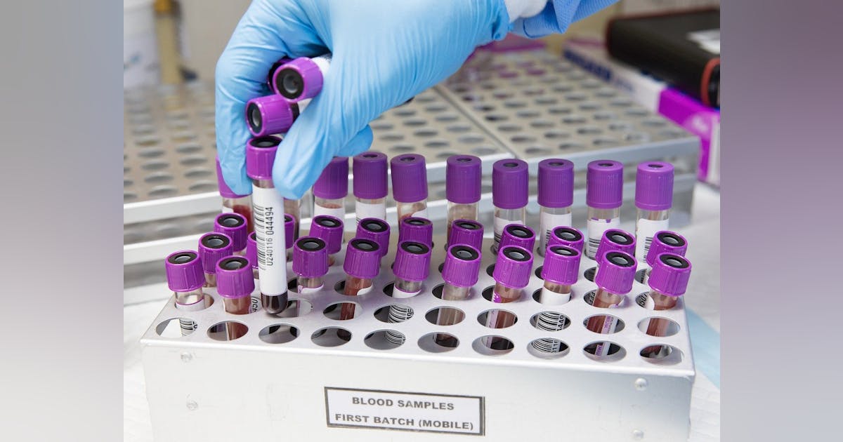 Beckman Coulter launches SARSCoV2 IgM Antibody Test, will begin