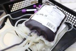 Pixabay Blood 5053766 1280 1 5f3e7e899660b Pixabay Blood 5053766 1280 1 5f3e7e899660b