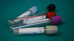 Pixabay Blood Test Tubes Laboratory 313864 1280