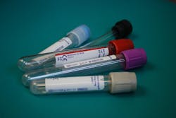 Pixabay Blood Test Tubes Laboratory 313864 1280 5f2d563fe450f Pixabay Blood Test Tubes Laboratory 313864 1280 5f2d563fe450f