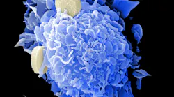 Unsplash Cancer National Cancer Institute Gy Gy I Eeik Sw Unsplash